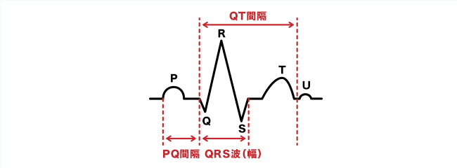 不良 高 r は 波 増 と 心電図 r